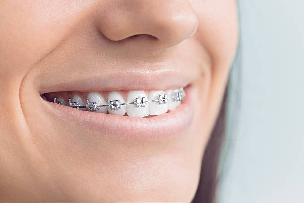 Best Full Mouth Reconstruction  in Saylorsburg, PA